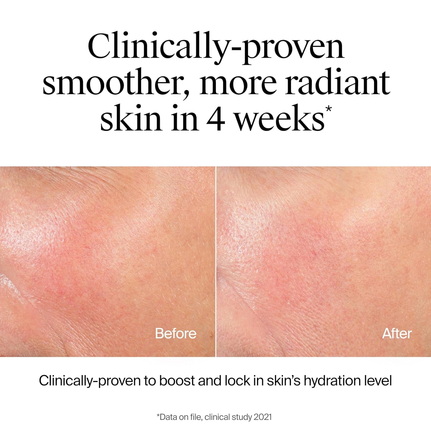 Hydro Boost Hydrating Face Wash & Makeup Remover, Gentle Facial Cleanser Gel with Hyaluronic Acid, Locks Moisture for Soft Supple Skin, Hypoallergenic, Oil-Free, Soap-Free, 7.8 Fl Oz