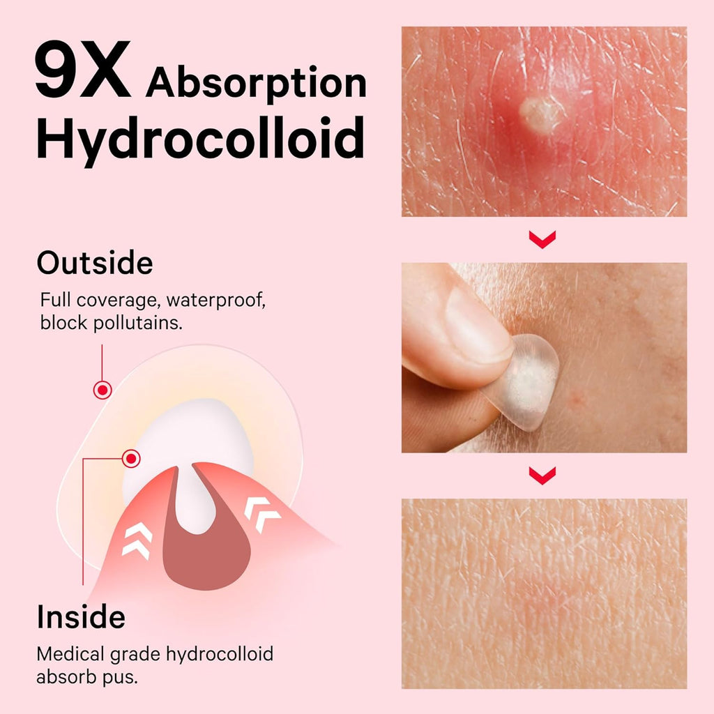 Pimple Patches for Face, Invisible Hydrocolloid Acne Patches, HSA Store Eligible Items, Zit Sticker for Face and Skin, Pimple Sticker for Covering Zits, Blemishes with Salicylic Acid 48 Count