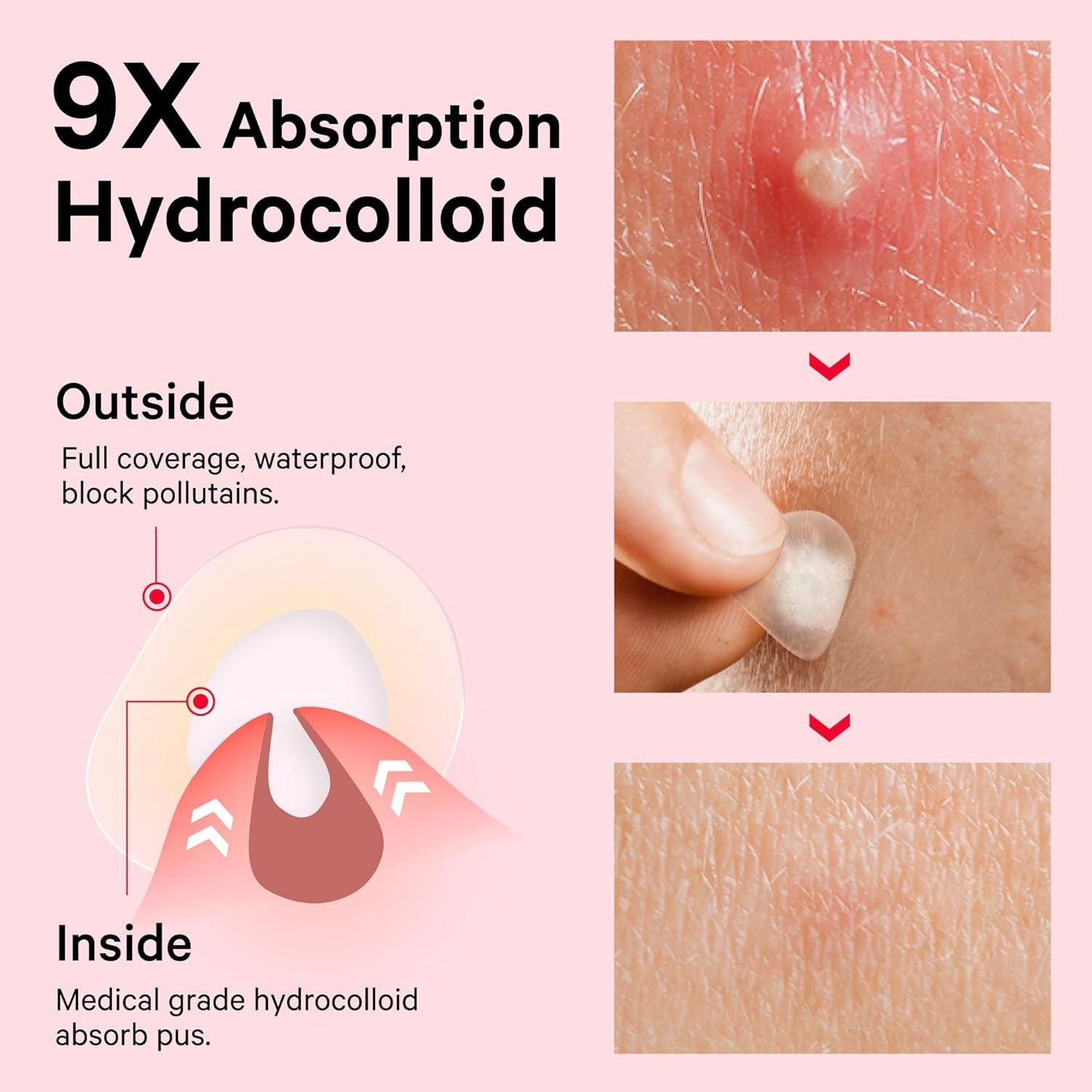 Pimple Patches for Face, Invisible Hydrocolloid Acne Patches, HSA Store Eligible Items, Zit Sticker for Face and Skin, Pimple Sticker for Covering Zits, Blemishes with Salicylic Acid 48 Count