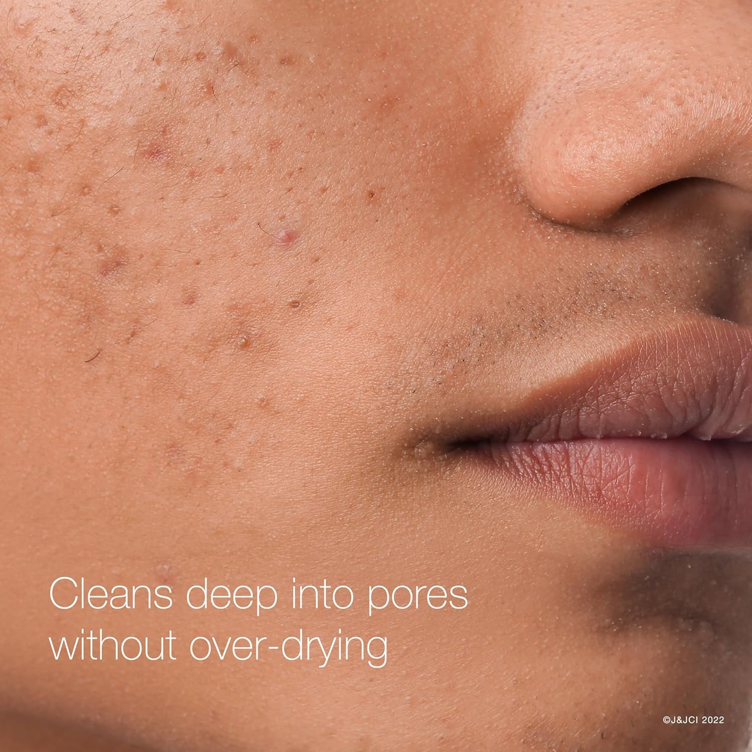 Rapid Clear Maximum Strength Acne Treatment Pads - Salicylic Acid Formula, Face Cleansing Pads, Oil Remover, Fights Pimples, 60 Count, Resealable Jar